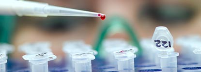 LECO-metabolomics_app-note01